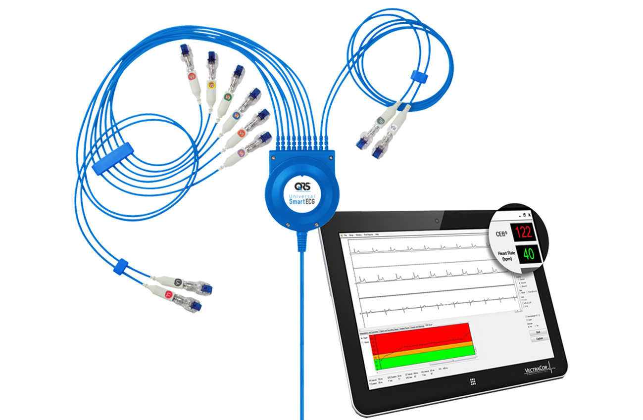 VectraCor QRS UniSmart ECG